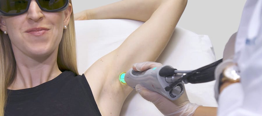 laser hair removal myths