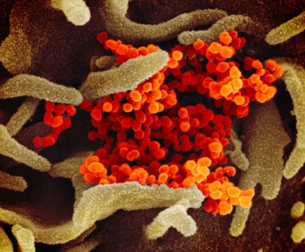 This scanning electron microscope image shows the virus that causes COVID-19 isolated from a patient in the U.S., emerging from the surface of cells (green) cultured in the lab.